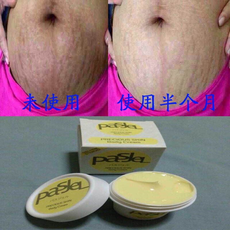 Stretch marks repair cream Pasjel Thailand Maternity